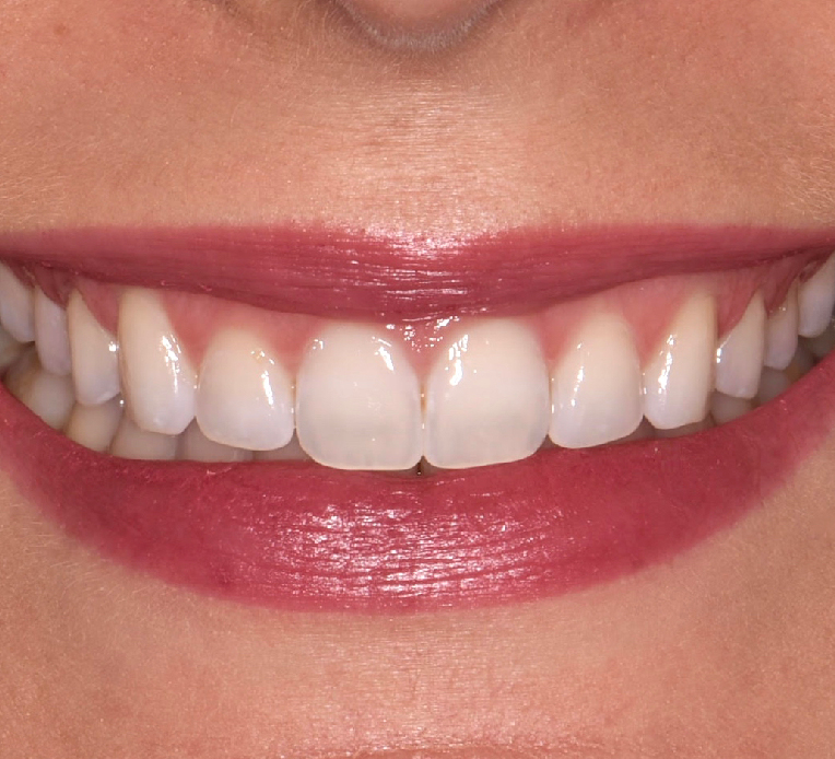 Estética Dental en Córdoba