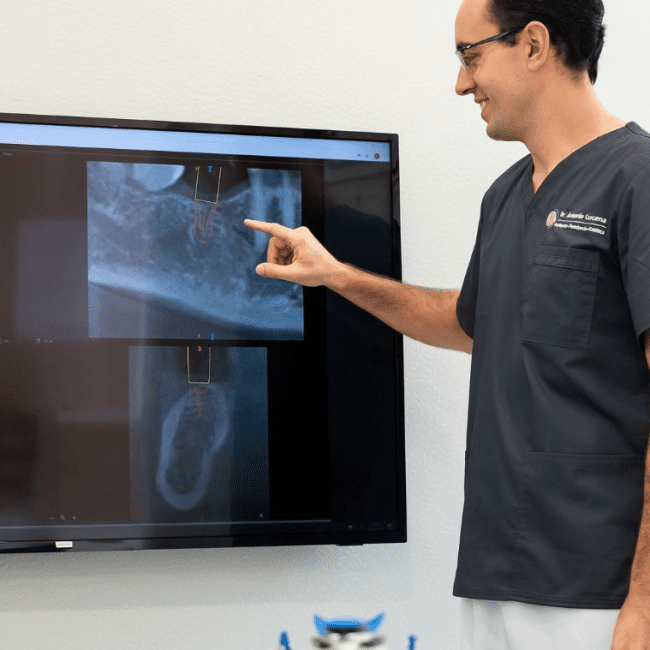 Tratamientos de endodoncia en Córdoba capital