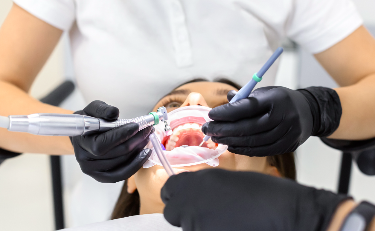 ¿Qué son las manchas en los dientes?