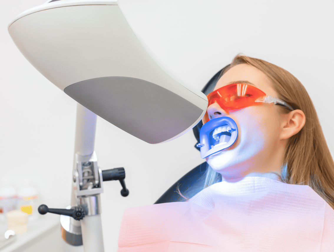 Tipos de blanqueamiento dental y efectividad
