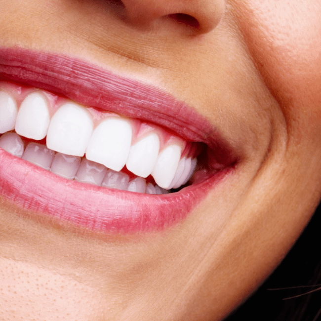 ¿Quién puede optar por implantes de carga inmediata?