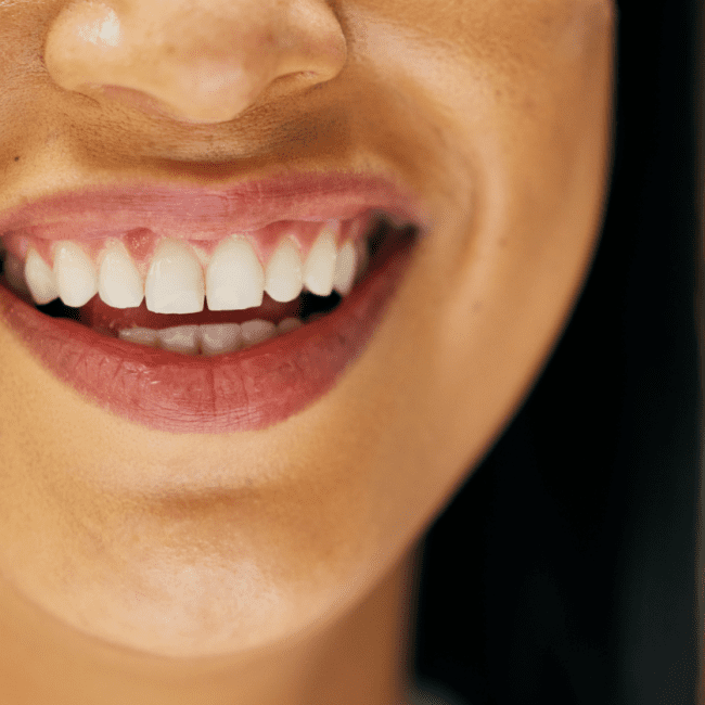 Técnicas para colocar implantes cuando hay poco hueso