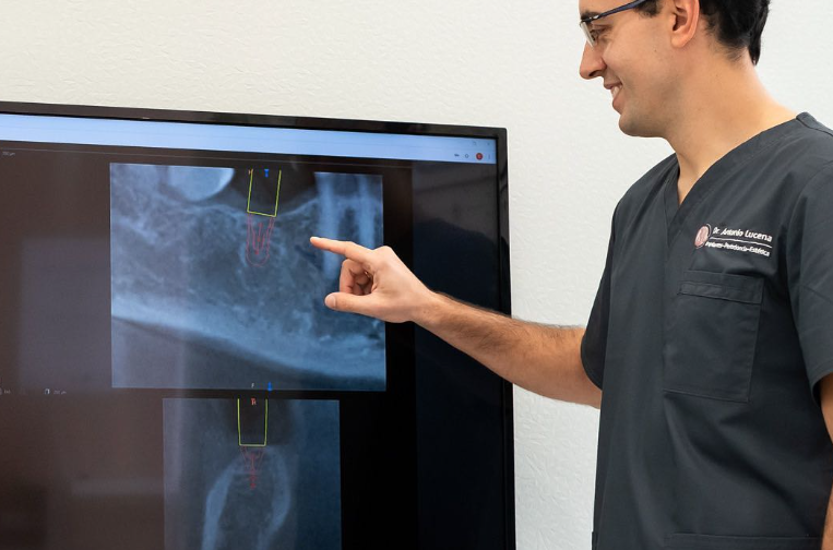 ¿Qué es y cuándo es necesaria una Endodoncia?