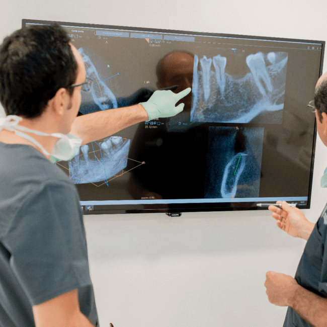 Implantes con poco hueso en Córdoba