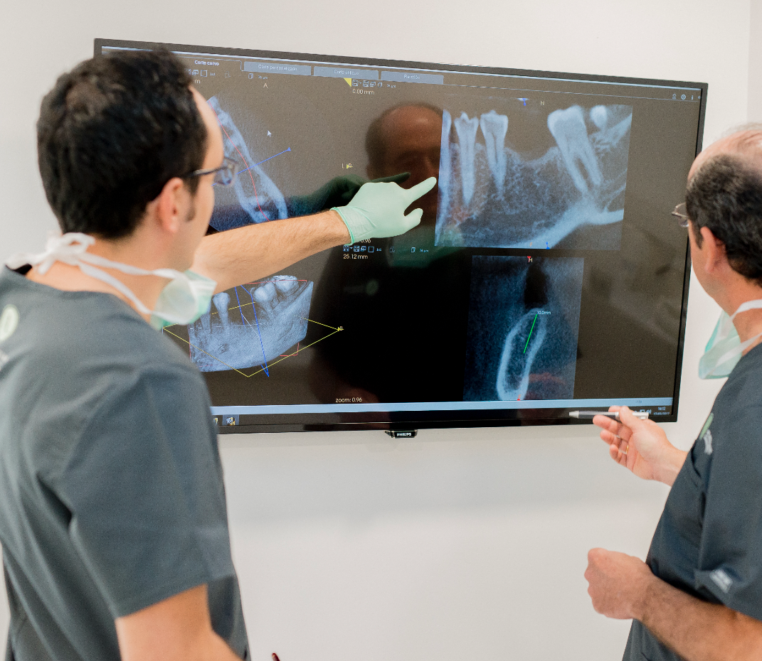 Implantes con poco hueso en Córdoba