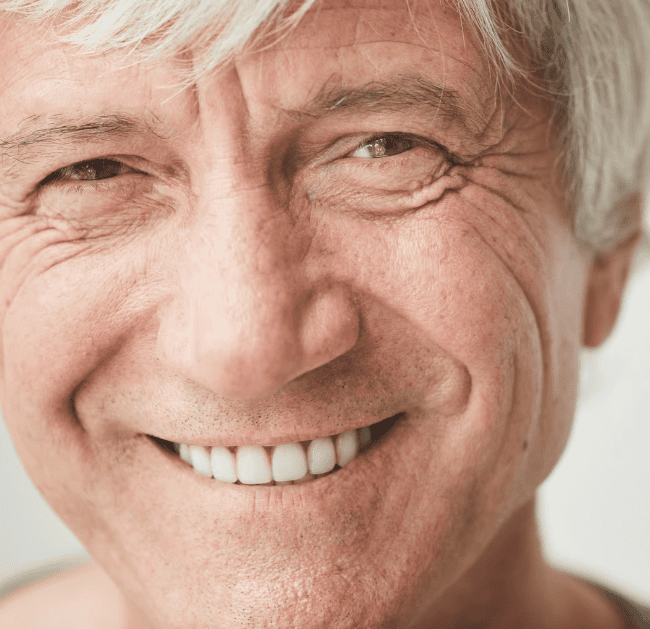 ¿Para quién están indicados los Implantes All on 4?
